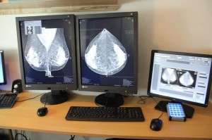 Mamografo 4